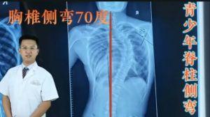 治脊椎视频